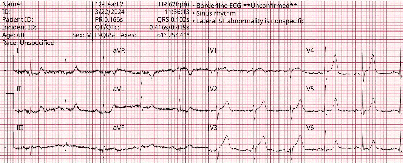 Presenting ECG — 2024 EMS Cases Part IV