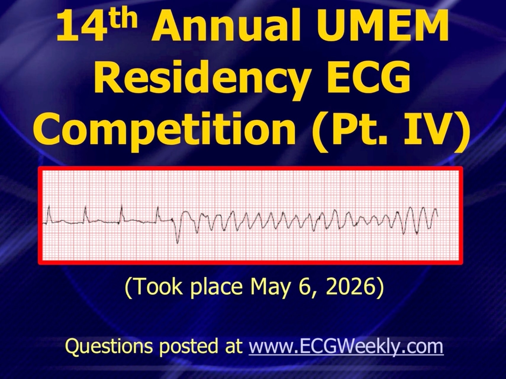 Presenting ECG — 2026 ECG Competition Answers (Part 4)