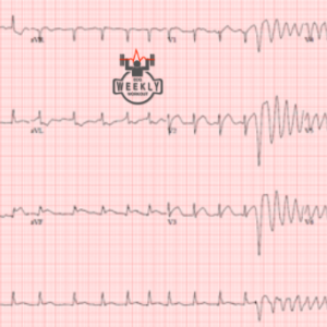 BER – ECG Weekly