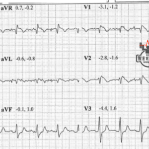 BER – ECG Weekly