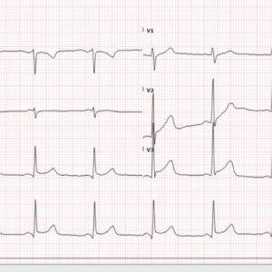 BER – ECG Weekly