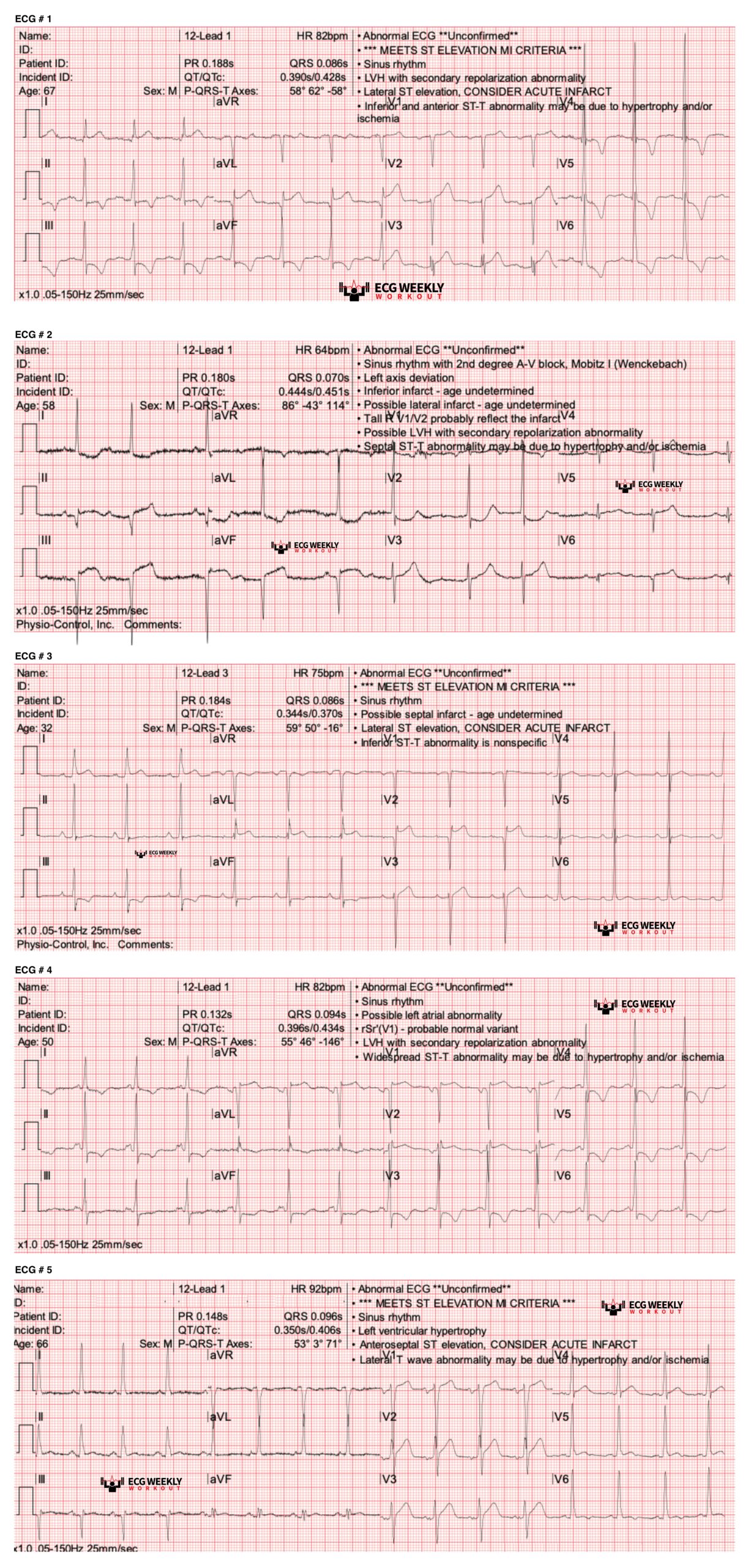 Echelon Ecg Part 2 Answers - 1iuywpp