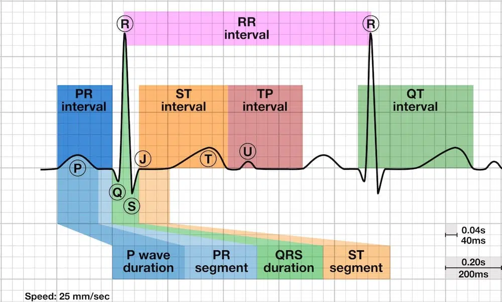 Annotated ECG showing labeled intervals and segments: PR interval (P wave + PR segment), QRS duration, ST segment/interval, TP interval (isoelectric baseline), QT interval (QRS onset to T end), and RR interval for rate. Paper speed 25 mm/s; small box ≈ 40 ms, large box ≈ 200 ms. From the LITFL ECG Library: https://litfl.com/r-wave-ecg-library/. 
