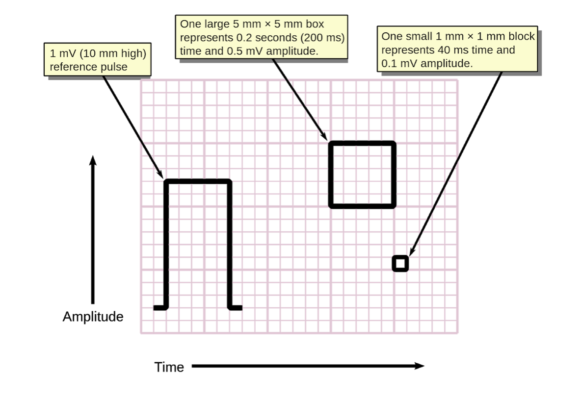 Screen Shot 2020-12-27 at 3.46.51 PM ECGs record cardiac waveforms generated by changes in voltage between different points on the body. These waveforms are displayed on ECG grid paper, which allows for precise measurement of time on the horizontal axis and voltage on the vertical axis.