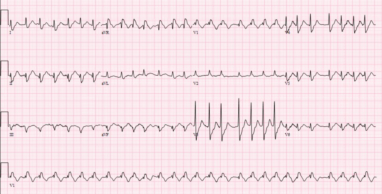 2025-ECG2 2025-ECG2