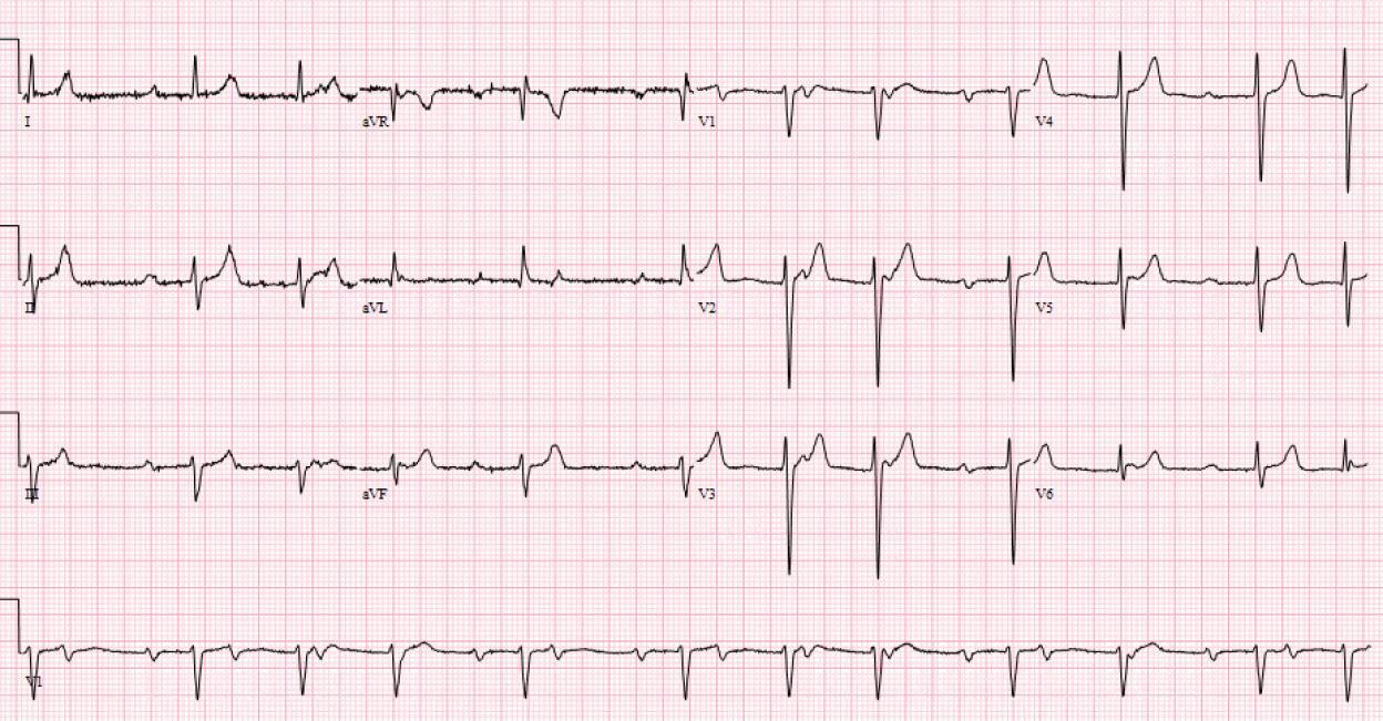 2025-ECG3 2025-ECG3