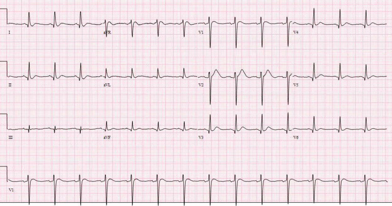2025-ECG4 2025-ECG4