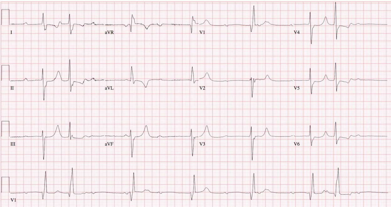 2025-ECG5 2025-ECG5