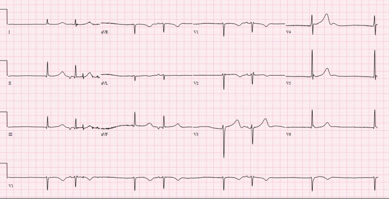 ECG10 ECG10