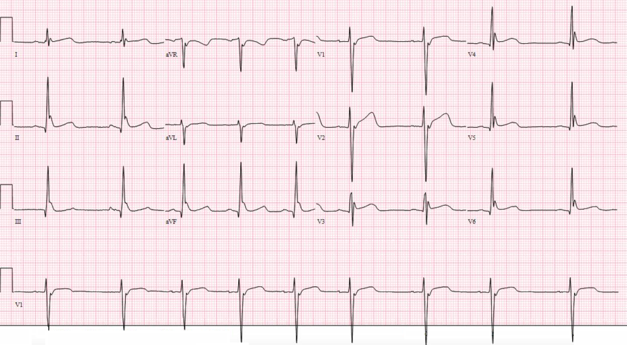 ecg9 ecg9